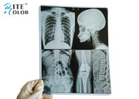 película seca de X Ray de la película de la proyección de imagen médica del ANIMAL DOMÉSTICO de 10 * 12 pulgadas para las impresoras de chorro de tinta