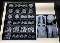 El ANIMAL DOMÉSTICO impermeable de 215 micrones basó X médico Ray Film