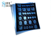 Chorro de tinta claro plástico X médico Ray Film Waterproof Blue Color 215mic