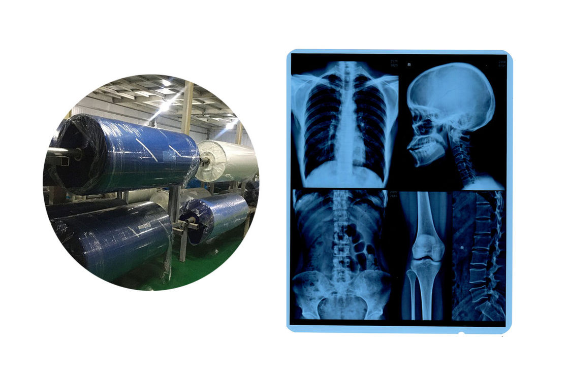 8x10 base azul X Ray Medical Imaging Film de 210 micrones