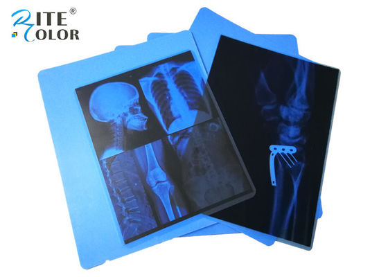 Impresoras azules de la proyección de imagen médica X Ray Film For Canon Pixma del ANIMAL DOMÉSTICO del chorro de tinta