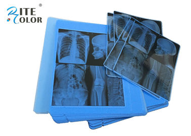 Grueso azul de la película 210um de la proyección de imagen médica de X Ray de la radiología para la impresora de chorro de tinta de Epson