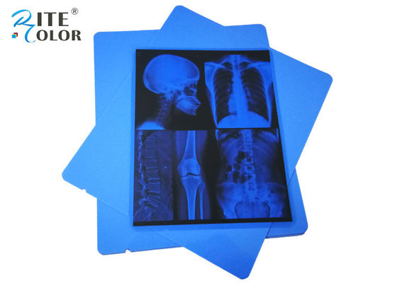 Película de rayos X médica de 210 micrones de color azul A4 PET de color seco de inyección de tinta