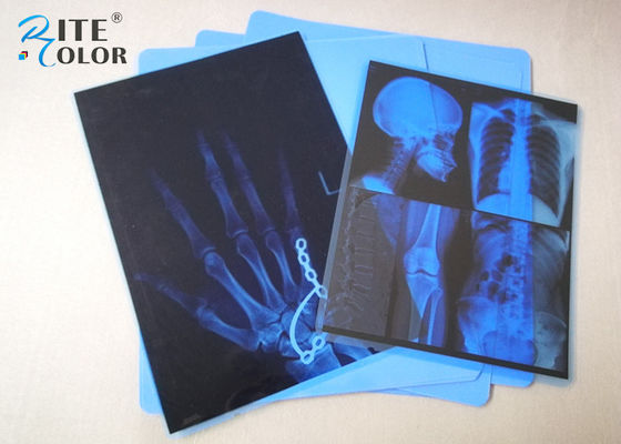 Película azul de la proyección de imagen médica del chorro de tinta del ANIMAL DOMÉSTICO de la niebla baja 8 x 10 pulgadas para la impresora de Epson