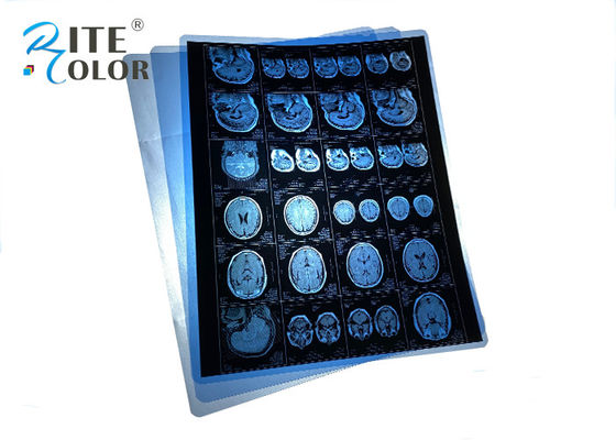 Película de rayos X médica PET azul impermeable para resonancia magnética CT CR Imágenes de panorama dental
