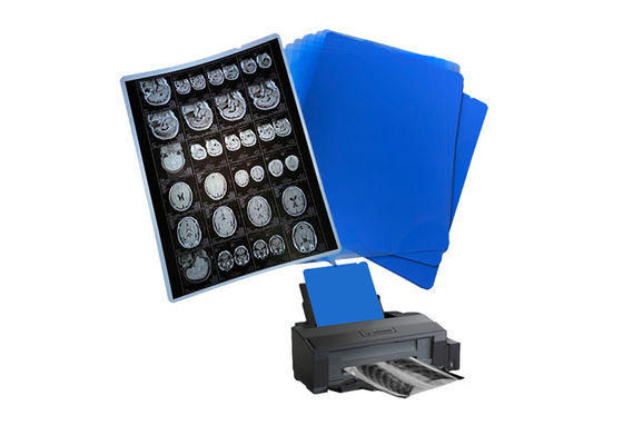 210um 8x10 A3 A4 Película azul de inyección de tinta médica para radiología